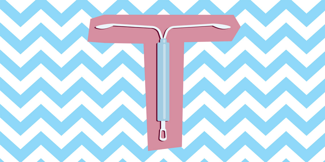 What it's like to get an IUD